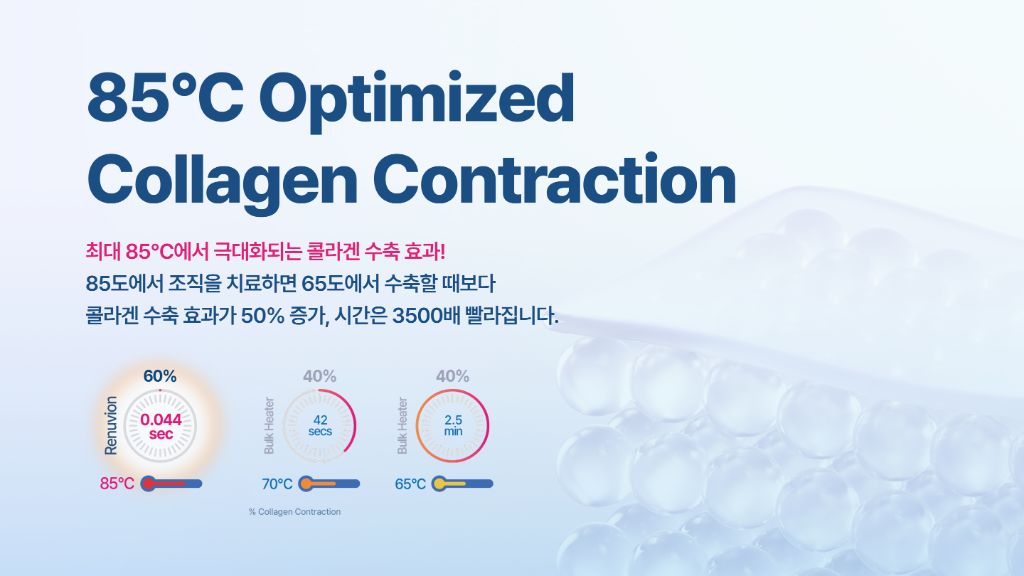 85°C Optimized Collagen Contraction — Renuvion 85°C 60% in 0.044 s; bulk heater 70°C 40% in 42 s; 65°C 40% in 2.5 min