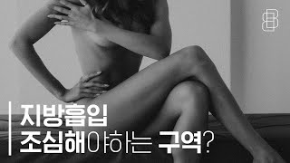 의사들도 무조건 주의하는 그 지방흡입! (Plastic surgeons are always cautious about liposuction.)