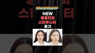 눈 밑 꺼짐 ,다크서클 한방에 해결 가능하다!