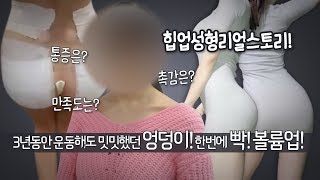 봉봉에서 힙업 제대로했다! 하이브리드 힙업성형 리얼스토리