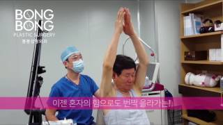 봉봉성형외과 줄기세포 관절 통증 치료! 제2부