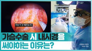 가슴 성형 시 내시경을 사용하는 이유는?