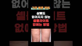 울퉁불퉁 셀룰라이트, 없애는 법 공개