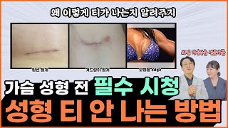 가슴성형 티 안나는 방법이 있다?! 가슴성형 전 필수 시청!