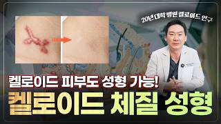 켈로이드 체질이라 성형수술이 망설여진다면? 꼭 알아야 할 3가지