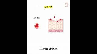 흉터치료 포기하지마세요 !