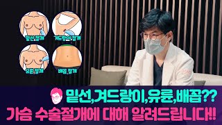 밑선,겨드랑이,유륜,배꼽까지? 가슴수술 절개법!