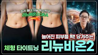 리뉴비온2 궁금증 총정리, 지방흡입 없이 받아도 될까? (feat. 거상술 대체 가능 여부)