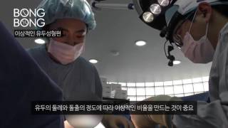 봉봉성형외과의 이상적인 유두성형 시술 (유두축소술)