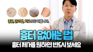 흉터없애는법, 흉터 제거를 원하면 ▶필독◀ (all about scars)