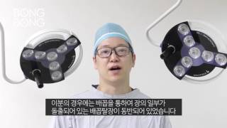 이상적인 배꼽을 위한 봉봉성형외과의 배꼽성형