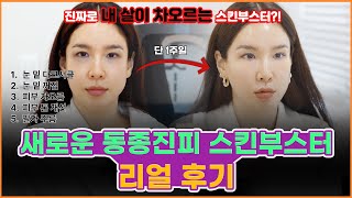 진짜 내 피부가 되는 스킨부스터?? ㅣ 요즘 핫한 스킨부스터 리얼 후기!