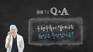 봉봉Q&A 구형구축이 일어나는 이유는?
