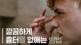 흉터치료를 포기 할 수 없는 이유! (The reason why I can't give up scar treatment.)