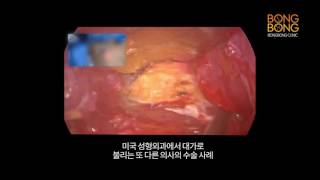 미국성형외과 또다른 전문의의 수술영상 공개!
