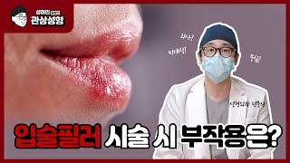 입술필러 시술 시 나타날 수 있는 부작용과 예방법은?