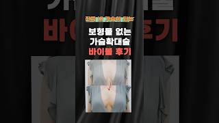 보형물 없이 가능한 가슴성형? 바이볼 수술 과정 공개!