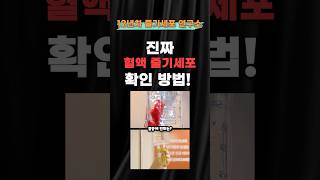 줄기세포 12년 연구, 진짜 줄기세포 구별하는 법!