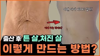 출산후 튼살없애기부터 처진뱃살 운동으로 안될때 탄력있게 개선법!