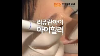 리쥬란 힐러 아이