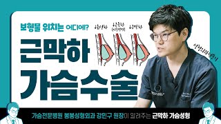 가슴 수술 시 보형물 넣는 위치는? 근막하 가슴성형 팩트체크!