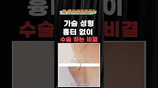 가슴성형, 흉터 없이 하는 방법! 왜 줄기세포일까?