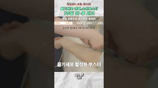 원장님이 직접 보여드립니다! 줄기세포 스킨부스터 전후비교