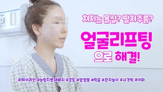 동안으로 보이는 마법? 얼굴리프팅