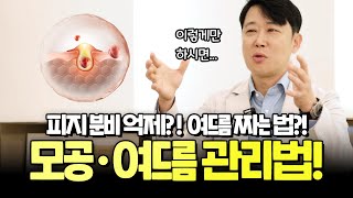 피지분비억제? 여드름짜는법? 효과적인 모공 및 여드름 관리법!